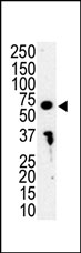 AP14603PU-N - IRAK3