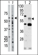 AP14607PU-N - Activin receptor type 1 / ACRV1