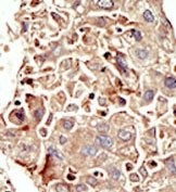 AP14607PU-N - Activin receptor type 1 / ACRV1