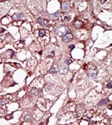AP14608PU-N - ACVRL1 / ALK1
