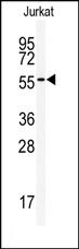 AP14609PU-N - ACVRL1 / ALK1