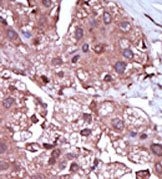 AP14609PU-N - ACVRL1 / ALK1