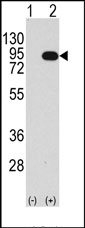 AP14615PU-N - B-Raf proto-oncogene