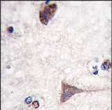 AP14615PU-N - B-Raf proto-oncogene