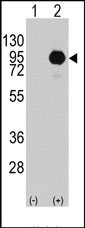 AP14616PU-N - B-Raf proto-oncogene