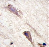 AP14620PU-N - B-Raf proto-oncogene