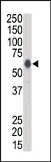AP14625PU-N - Kinase suppressor of Ras 1
