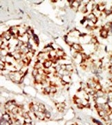 AP14625PU-N - Kinase suppressor of Ras 1