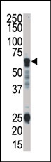 AP14643PU-N - RIPK3 / RIP3