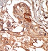 AP14643PU-N - RIPK3 / RIP3