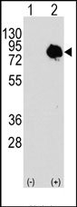 AP14652PU-N - Transglutaminase-2 (TGM2)