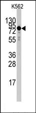 AP14653PU-N - Transglutaminase-2 (TGM2)