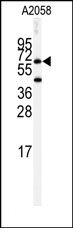 AP14658PU-N - Cholinesterase
