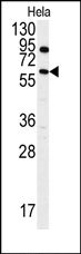 AP14524PU-N - Anthrax toxin receptor 1 / ANTXR1