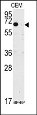 AP14528PU-N - KLF10 / TIEG1