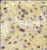 AP14543PU-N - HIF1A / HIF1 alpha