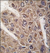 AP14545PU-N - BICD2