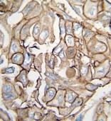 AP14550PU-N - HRAS