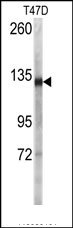 AP14590PU-N - Desmoglein-2