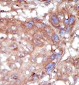 AP14454PU-N - TNK2 / ACK1