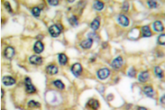 AP06120PU-N - CD333 / FGFR3