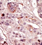 AP14477PU-N - SRMS
