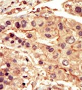 AP14478PU-N - SRMS