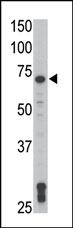 AP14483PU-N - TXK / PTK4