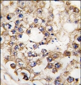 AP14510PU-N - Insulin promoter factor 1