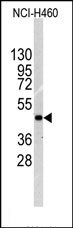 AP14367PU-N - Integrin-linked protein kinase