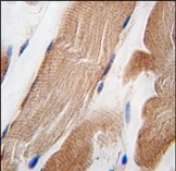 AP14367PU-N - Integrin-linked protein kinase