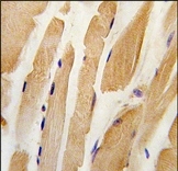 AP14369PU-N - Integrin-linked protein kinase