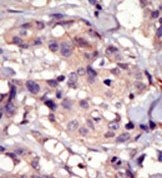 AP14390PU-N - CD140a / PDGFRA