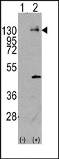 AP14392PU-N - CD140a / PDGFRA