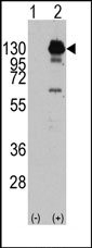 AP14394PU-N - CD140a / PDGFRA