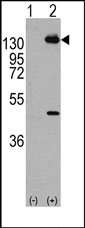 AP14396PU-N - CD140a / PDGFRA