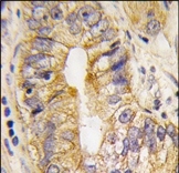 AP14396PU-N - CD140a / PDGFRA