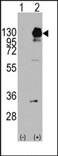 AP14398PU-N - CD140a / PDGFRA