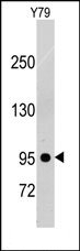 AP14406PU-N - CD140b / PDGFRB