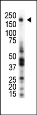 AP14419PU-N - CD136 / MST1R