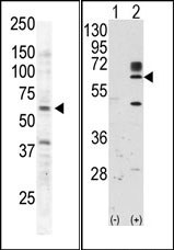 AP14421PU-N - Tyrosine-protein kinase RYK