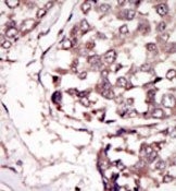 AP14422PU-N - Tyrosine-protein kinase RYK