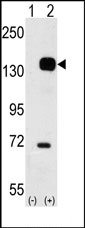 TA300046 - CD202b / TEK