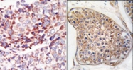 TA300046 - CD202b / TEK