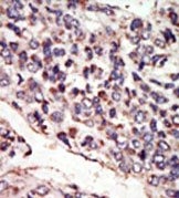 AP14438PU-N - TrkC