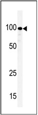 AP13878PU-N - Kinase suppressor of Ras 1