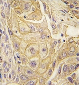 AP14298PU-N - EPHB2