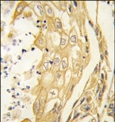 AP14301PU-N - EPHB4
