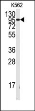AP14337PU-N - FGFR1