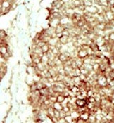AP14339PU-N - CD332 / FGFR-2